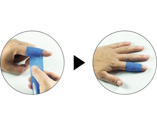 Anwendung von elastischer Fixierbinde am Finger dargestellt