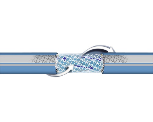 Réparation de tuyau avec un stent pour rétablir le débit